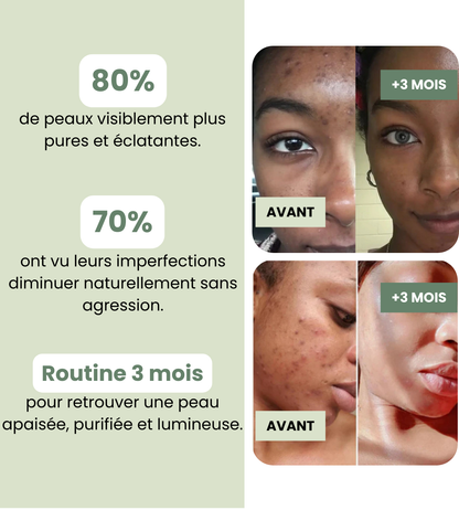 Masque Argile Vert